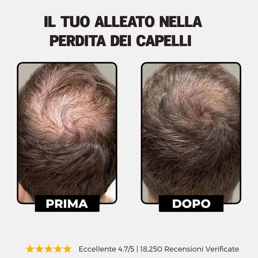 Shampoo attivatore delle radici -crescita capelli